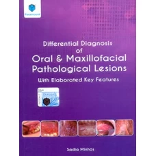 Differential Diagnosis of Oral and Maxillofacial Pathological Lesions