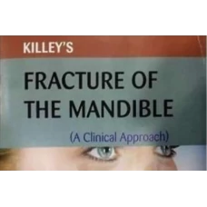 Killeys Fracture of the Mandible 7th edition by Peter Banks