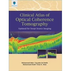 CLINICAL ATLAS OF OPTICAL COHERENCE TOMOGRAPHY: UPDATED FOR SWEPT SOURCE IMAGING 2019 - Paramount