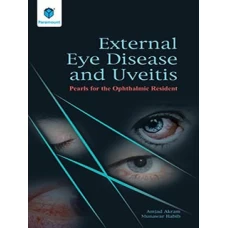 EXTERNAL EYE DISEASE AND UVEITIS: PEARLS FOR THE OPHTHALMIC RESIDENT 2020 - Paramount