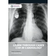 Learn Through Cases CXR In Cardiology By Dr Haseeb Raza - Nishtar Publications
