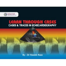 Learn Through Cases & Traces in Echocardiography Dr Haseeb Raza - Nishtar Publications